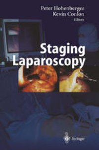 cover of the book Staging Laparoscopy