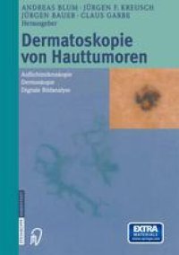 cover of the book Dermatoskopie von Hauttumoren: Auflichtmikroskopie — Dermoskopie — Digitale Bildanalyse