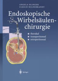 cover of the book Endoskopische Wirbelsäulenchirurgie: thorakal · transperitoneal · retroperitoneal