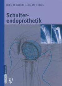 cover of the book Schulterendoprothetik: Indikation, Implantate, OP-Technik, Nachbehandlung, Begutachtung