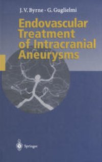 cover of the book Endovascular Treatment of Intracranial Aneurysms