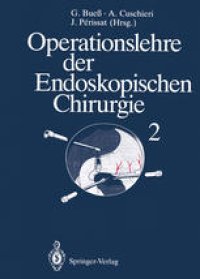 cover of the book Operationslehre der Endoskopischen Chirurgie: Band 2