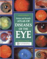 cover of the book Perkins and Hansell's Atlas of Diseases of the Eye