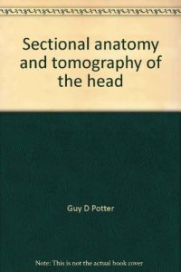 cover of the book Sectional Anatomy and Tomography of the Head