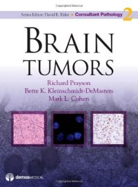 cover of the book Brain Tumors