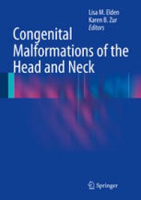 cover of the book Congenital Malformations of the Head and Neck