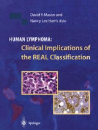 cover of the book Human Lymphoma: Clinical Implications of the REAL Classification