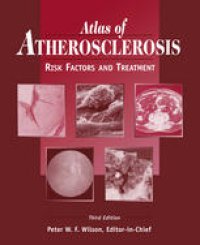 cover of the book Atlas of Atherosclerosis: Risk Factors and Treatment