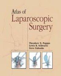 cover of the book Atlas of Laparoscopic Surgery