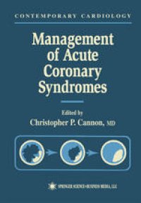 cover of the book Management of Acute Coronary Syndromes