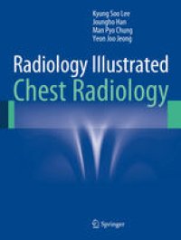 cover of the book Radiology Illustrated: Chest Radiology