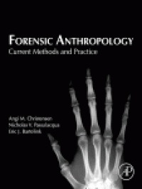 cover of the book Forensic Anthropology. Current Methods and Practice