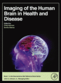 cover of the book Imaging of the Human Brain in Health and Disease