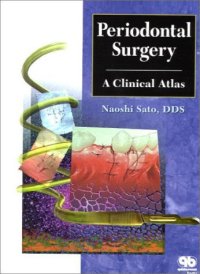 cover of the book periodontal surgery