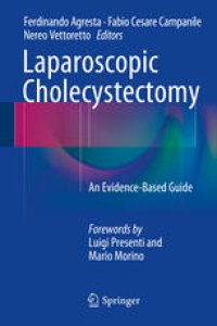 cover of the book Laparoscopic Cholecystectomy: An Evidence-Based Guide