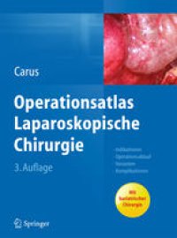 cover of the book Operationsatlas Laparoskopische Chirurgie