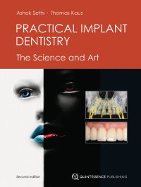 cover of the book Practical implant dentistry: the science and art