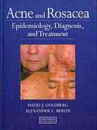 cover of the book Acne and Rosacea: Epidemiology, Diagnosis and Treatment