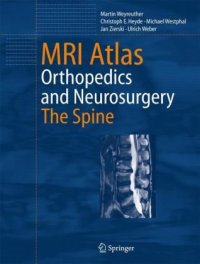 cover of the book MRI Atlas of MS Lesions