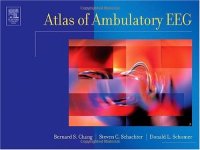 cover of the book Atlas of Ambulatory EEG