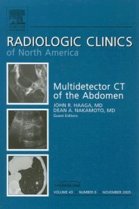 cover of the book MDCT of the Abdomen, An Issue of Radiologic Clinics