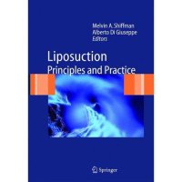 cover of the book Shiffman Liposuction-Principles and Practice