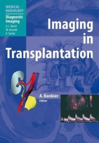 cover of the book Imaging in Transplantation