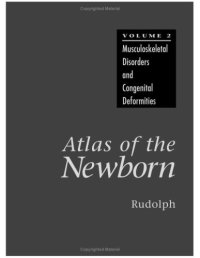 cover of the book Atlas of the Newborn. Musculoskeletal Disorders