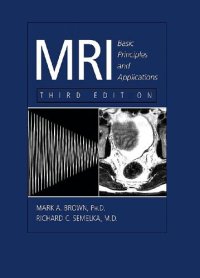 cover of the book MRI Basic Principles and Applications