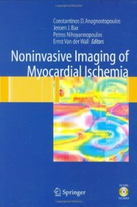 cover of the book Noninvasive Imaging of Myocardial Ischemia