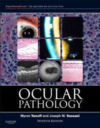 cover of the book Ocular pathology