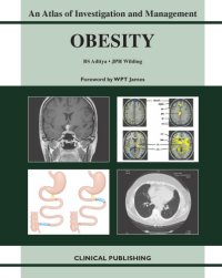 cover of the book Obesity - An Atlas of Investigation and Management