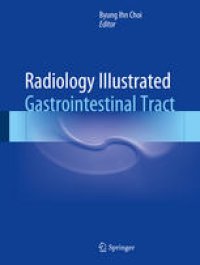 cover of the book Radiology Illustrated: Gastrointestinal Tract