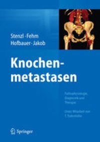 cover of the book Knochenmetastasen: Pathophysiologie, Diagnostik und Therapie - Unter Mitarbeit von T. Todenhöfer