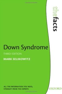 cover of the book Down Syndrome