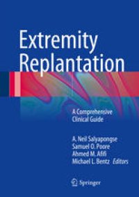 cover of the book Extremity Replantation: A Comprehensive Clinical Guide