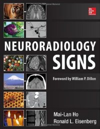 cover of the book Neuroradiology Signs