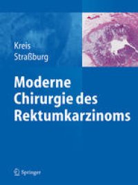 cover of the book Moderne Chirurgie des Rektumkarzinoms