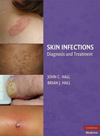 cover of the book Skin Infections: Diagnosis and Treatment