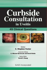 cover of the book Curbside Consultation in Uveitis: 49 Clinical Questions