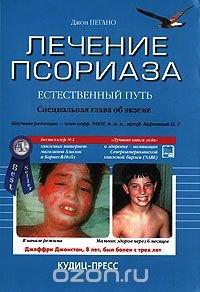 cover of the book Лечение псориаза - естественный путь