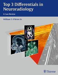 cover of the book Top 3 Differentials in Neuroradiology