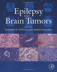 cover of the book Epilepsy and Brain Tumors