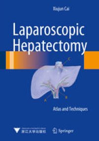 cover of the book Laparoscopic Hepatectomy: Atlas and Techniques