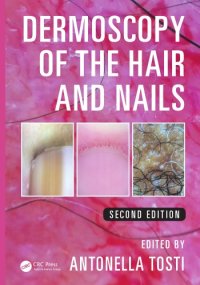 cover of the book Dermoscopy of the hair and nails