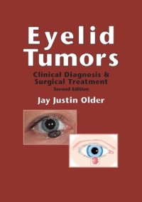 cover of the book Eyelid tumors : clinical evaluation and reconstruction techniques