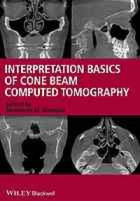 cover of the book Interpretation basics of cone beam computed tomography