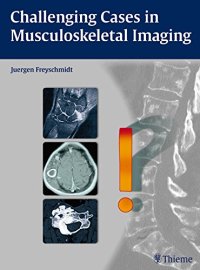 cover of the book Challenging Cases in Musculoskeletal Imaging