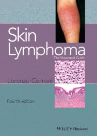 cover of the book Skin Lymphoma: The Illustrated Guide