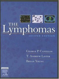 cover of the book The Lymphomas